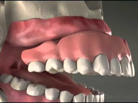 Eating With Dentures Brownsville TN 38012